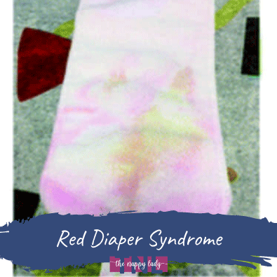 red diaper syndrome