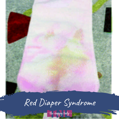 Red Diaper Syndrome