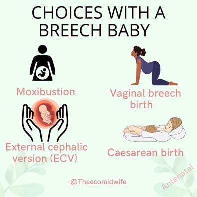 Breech Baby