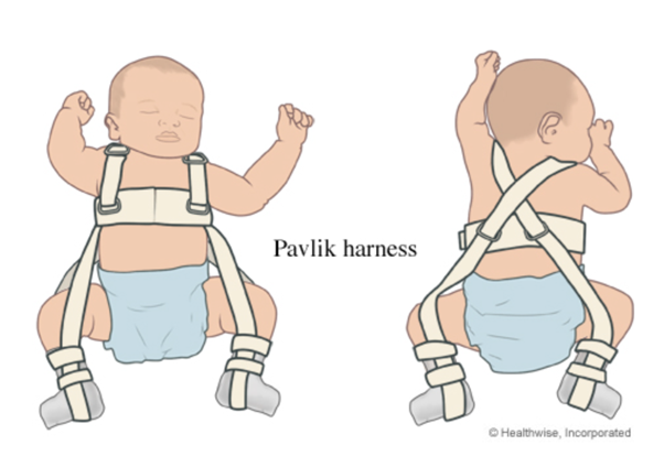 Pavlik Harness